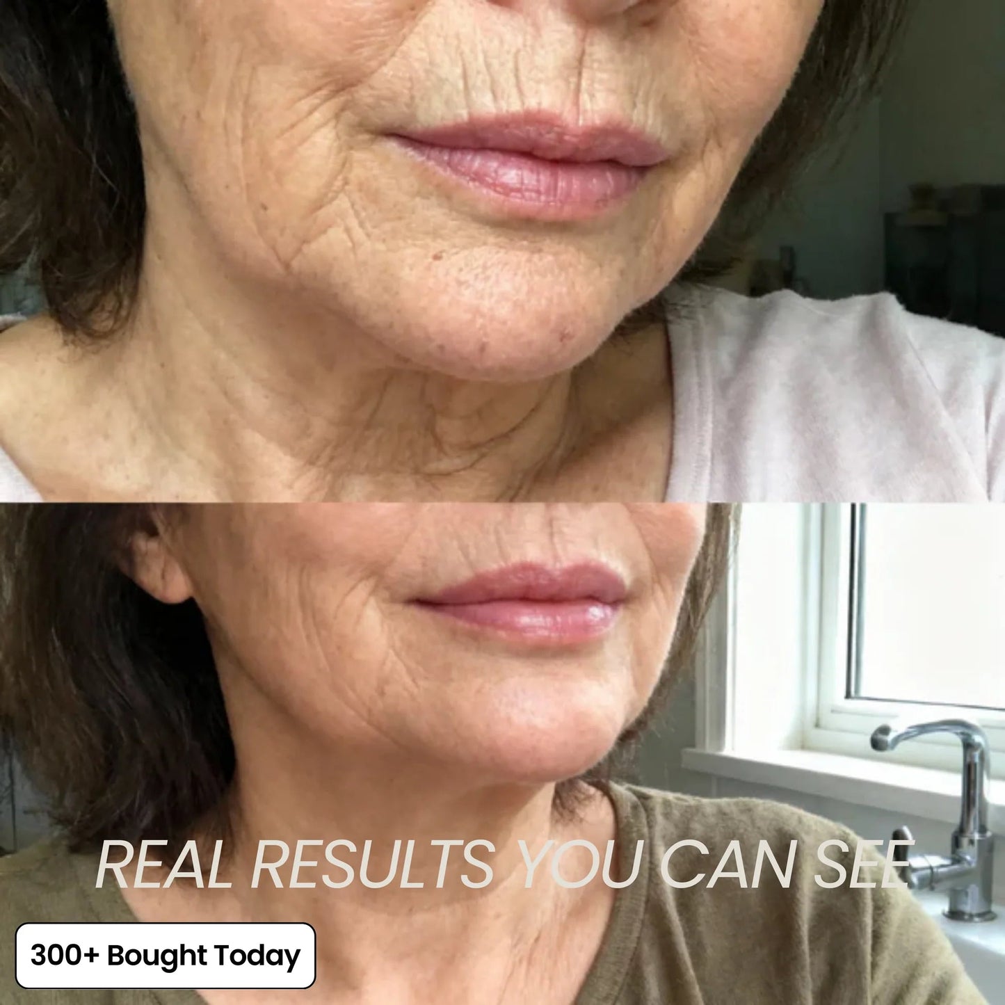 🔥LAST DAY 60% OFF 2026 Pro PIPIMYFCL Korean Pink Collagen Multi Balm