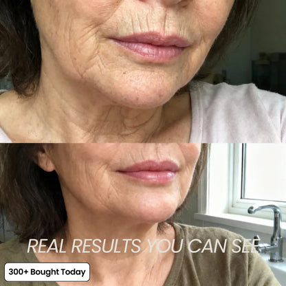 🔥LAST DAY 60% OFF 2026 Pro PIPIMYFCL Korean Pink Collagen Multi Balm