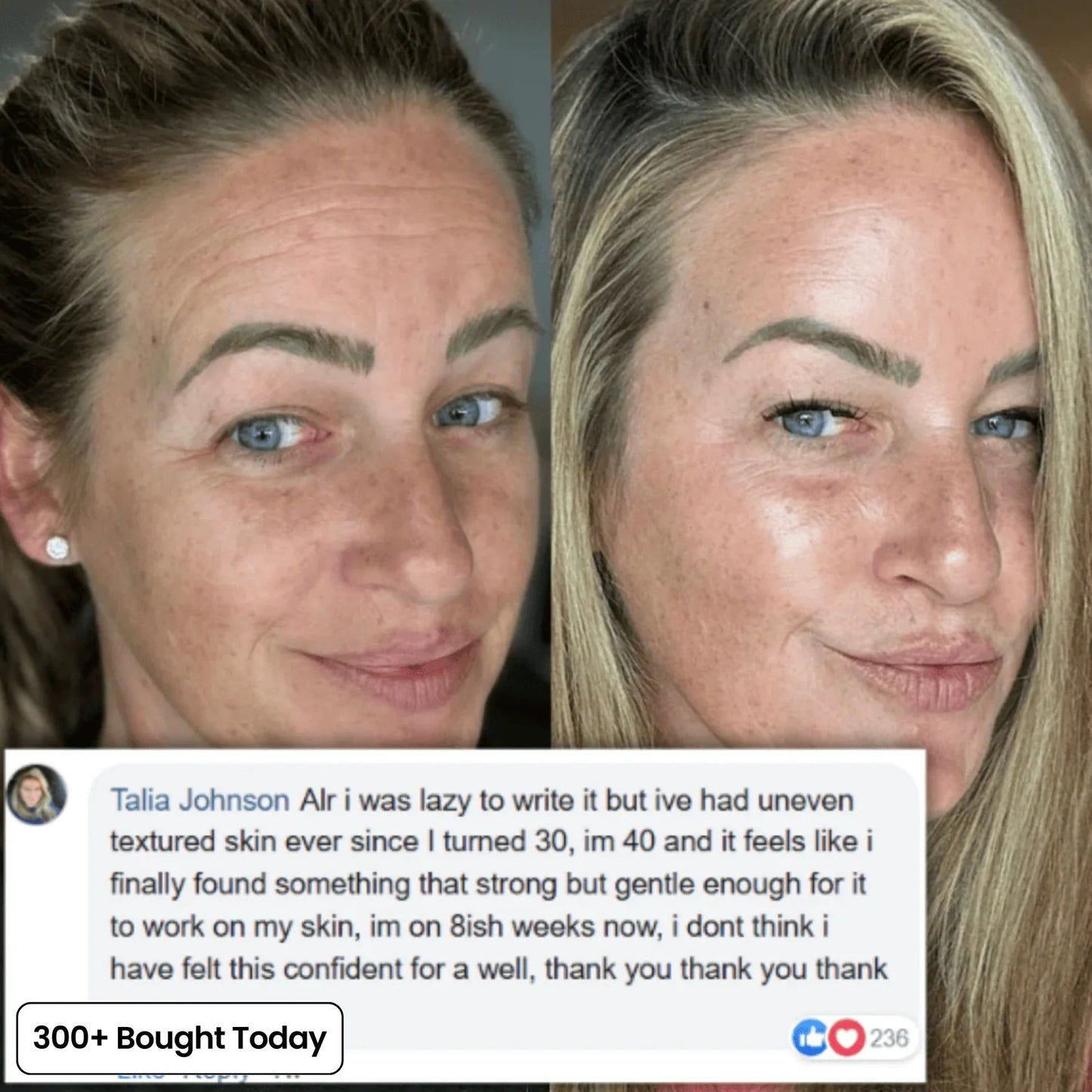 🔥LAST DAY 60% OFF 2026 Pro PIPIMYFCL Korean Pink Collagen Multi Balm