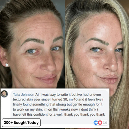🔥LAST DAY 60% OFF 2026 Pro PIPIMYFCL Korean Pink Collagen Multi Balm